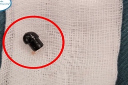 Bé 7 tuổi tử vong do hóc đầu bút bi trong lớp học
