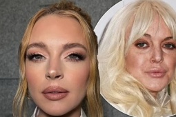 Bác sĩ thẩm mỹ kinh ngạc trước sự 'lột xác' của Lindsay Lohan