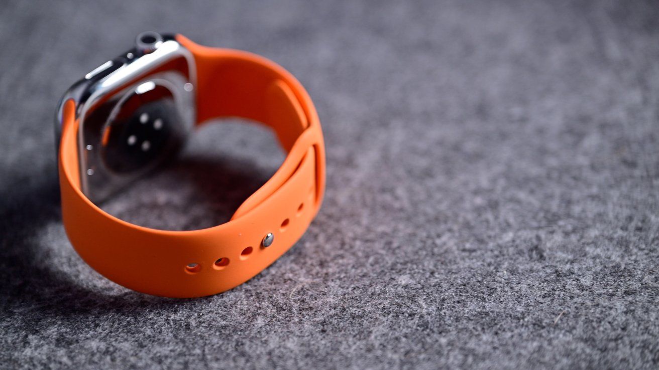 Dây đeo Apple Watch Series 11 Hermes.