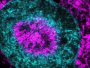 Phát hiện "chìa khóa" ngăn ung thư trước khi di căn