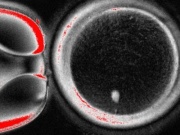 Thêm bước tiến trong nỗ lực giúp con người thụ thai