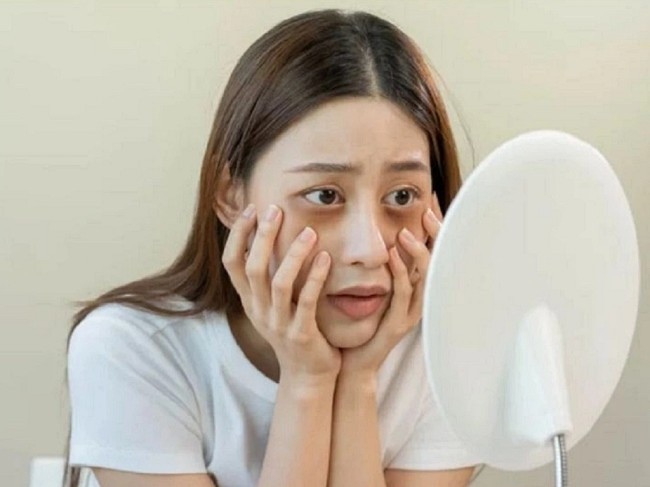Vì sao chăm chỉ thoa kem mắt quanh năm suốt tháng nhưng mắt vẫn 