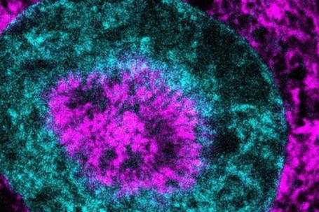 Phát hiện "chìa khóa" ngăn ung thư trước khi di căn