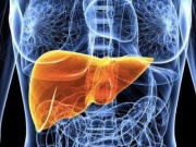 Bác sĩ cảnh báo: 5 dấu hiệu men gan tăng cao, gan đang 'kêu cứu' mà bạn không hay biết