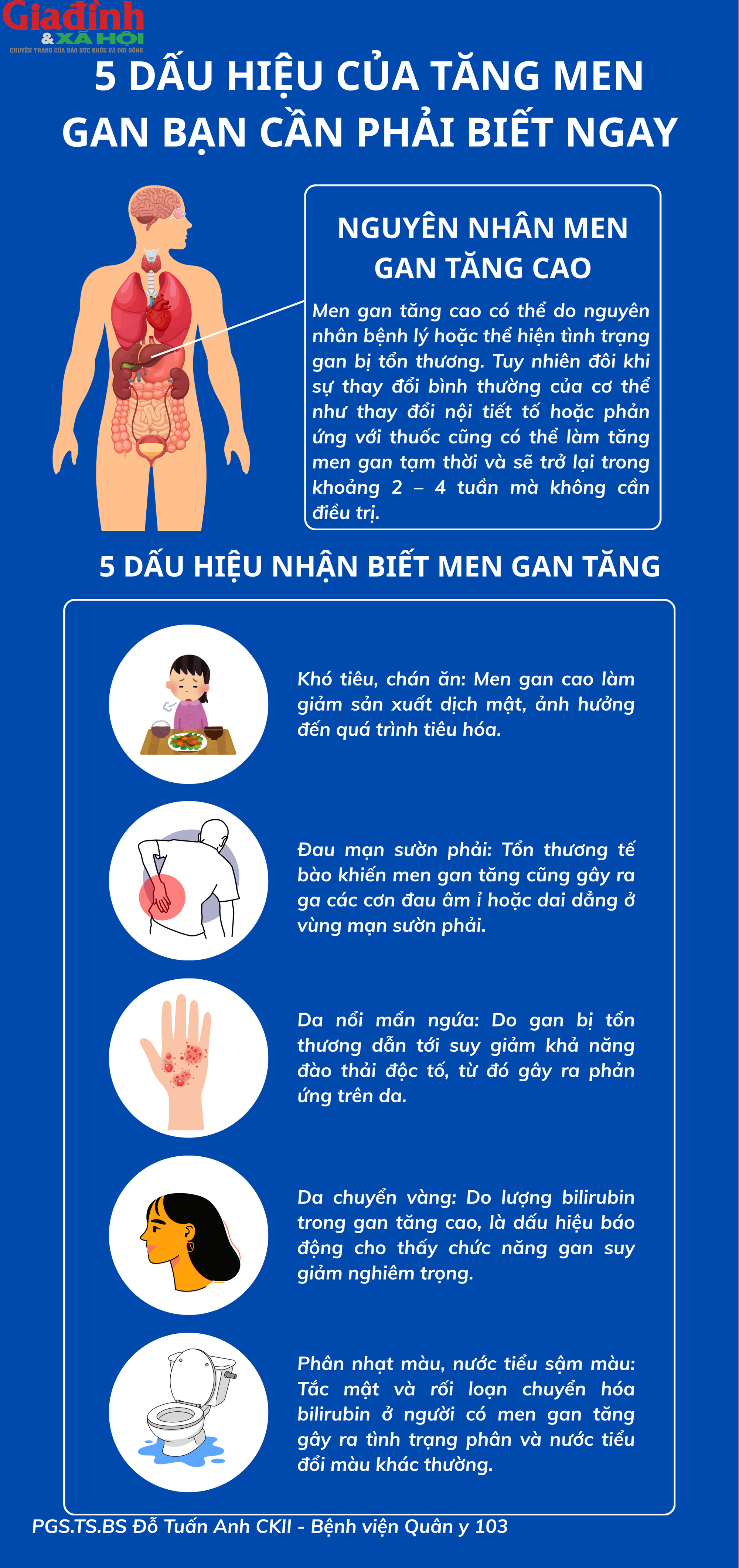Bác sĩ cảnh báo: 5 dấu hiệu men gan tăng cao, gan đang &#39;kêu cứu&#39; mà bạn không hay biết - 1