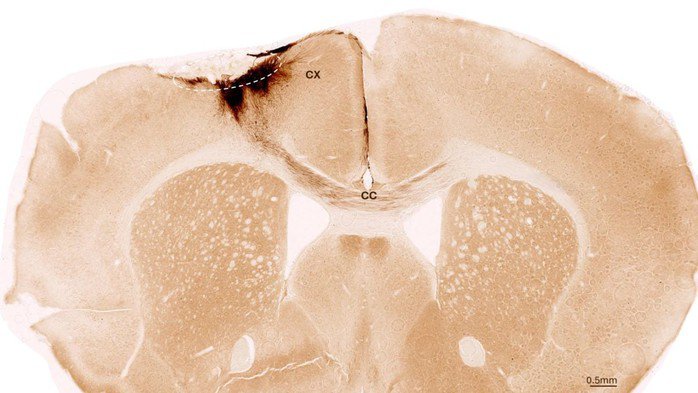 Hình ảnh này chụp cắt lớp não chuột sau đột quỵ và ghép tế bào gốc thần kinh, với vòng tròn nét đứt đánh dấu vùng bị đột quỵ, trong khi các nhánh thần kinh được tạo ra từ tế bào gốc của người được tô màu nâu sẫm - Ảnh: ĐẠI HỌC ZURICH