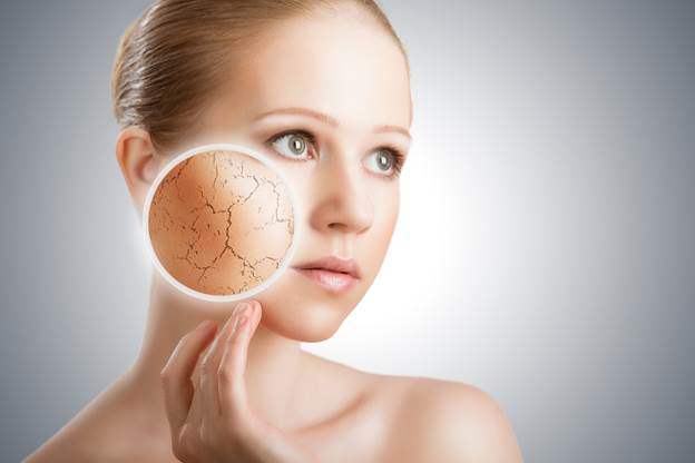 Mất collagen gây lão hóa da.