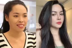 Nhan sắc hiện tại của hot girl từng 'lột xác' nhờ phẫu thuật thẩm mỹ