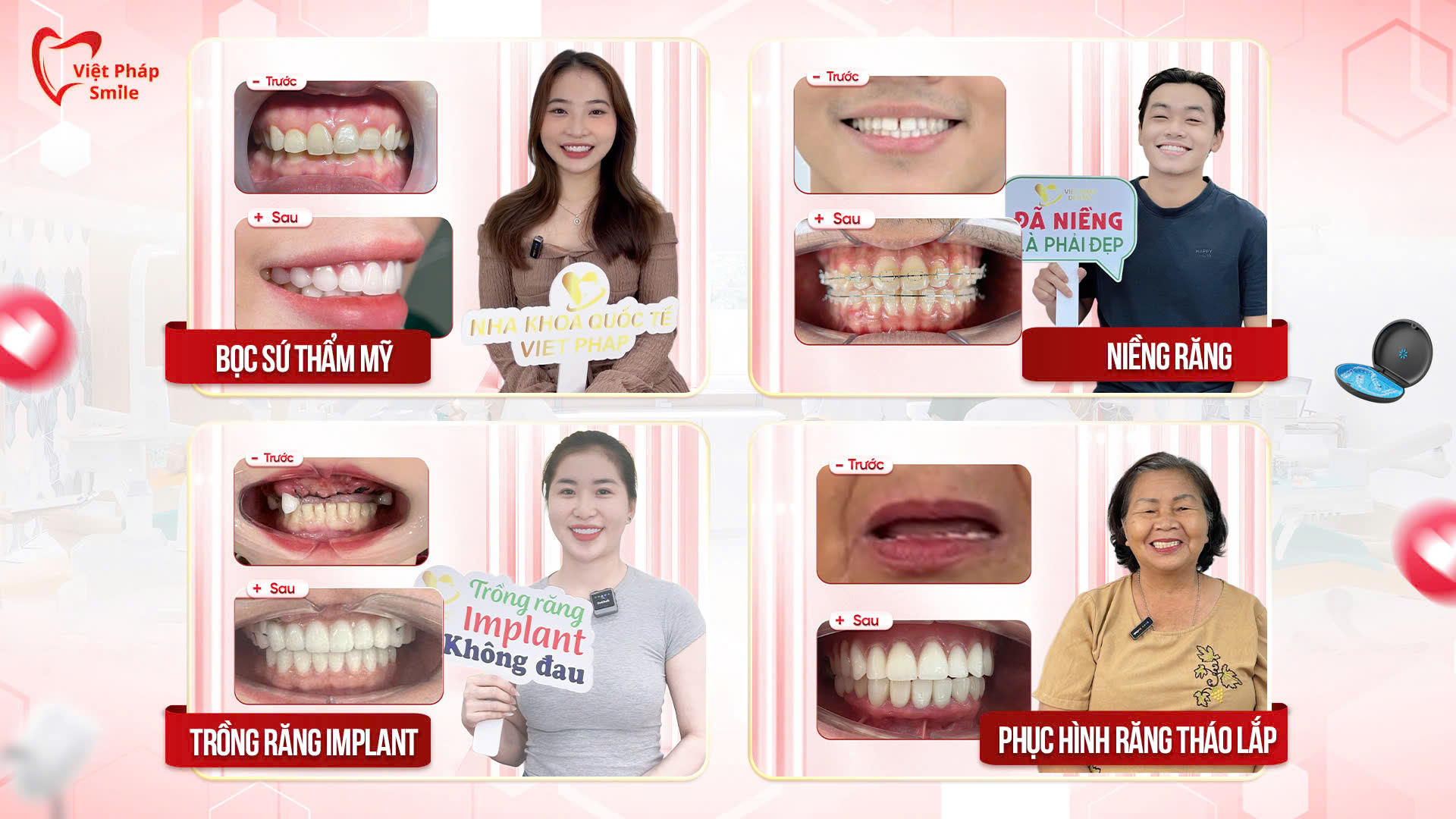 Nha khoa Việt Pháp Smile - điểm đến chăm sóc răng miệng uy tín tại Phường Trung Mỹ Tây - 4