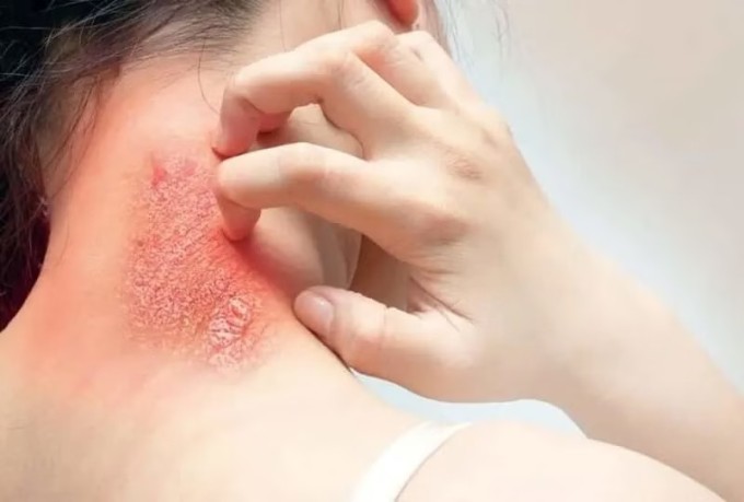 Da khô, ngứa nhiều, đặc biệt là về đêm, là dấu hiệu thận yếu ít người ngờ đến.