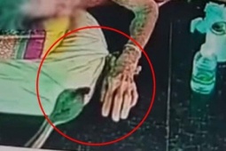 Đang nằm trên giường, cụ bà 93 tuổi bất ngờ bị rắn hổ mang cắn vào tay