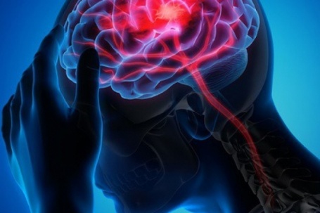 Hơn 99% các cơn đột quỵ và nhồi máu cơ tim liên quan 4 điều này