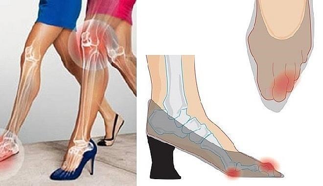 Giật mình: 6 thói quen tưởng vô hại nhưng lại tàn phá xương khớp cực nhanh - 2