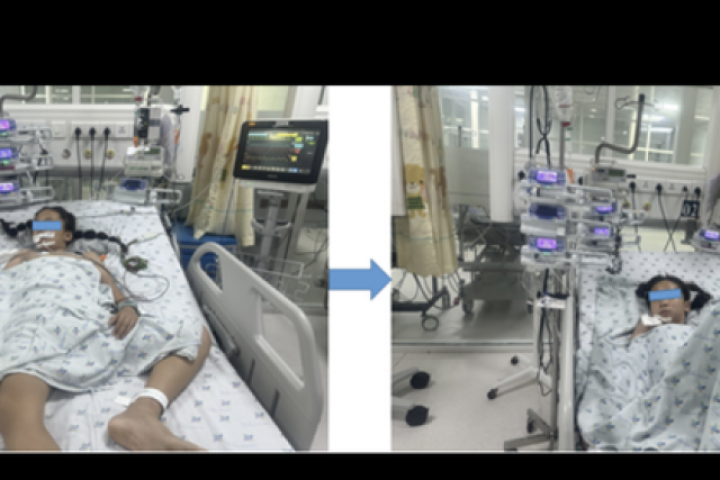 Bé gái ở An Giang mắc căn bệnh hiếm, với chưa đến 12 ca ở trẻ em được báo cáo trên y văn thế giới