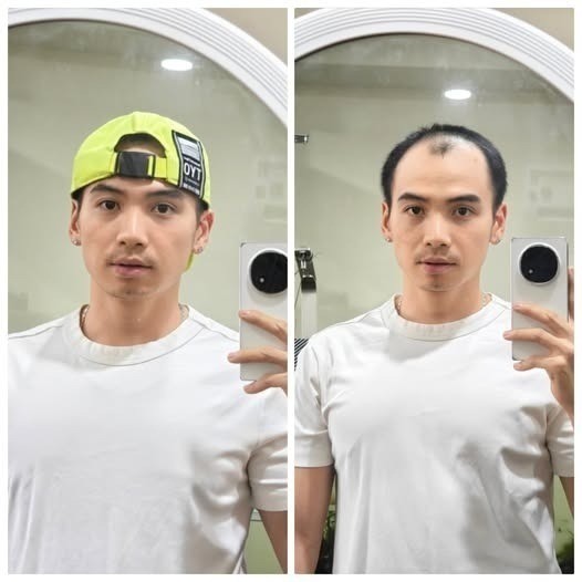 Tuấn Khôi tiết lộ lý do dở khóc, dở cười khiến trước đây anh thường xuyên đội mũ.