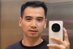 Phong độ chồng H'Hen Niê sau gần nửa năm cấy tóc