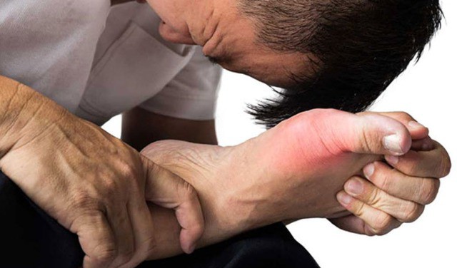 Cơn đau gout cấp tính có thể bùng phát chỉ sau vài giờ uống bia, dù trước đó đã kiêng thịt nghiêm ngặt.