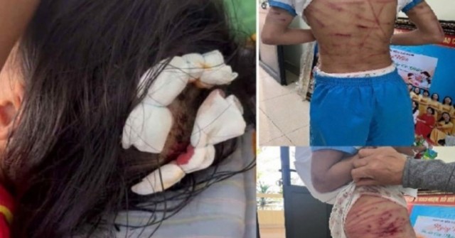 Bắt khẩn cấp cha dượng bạo hành dã man con riên...