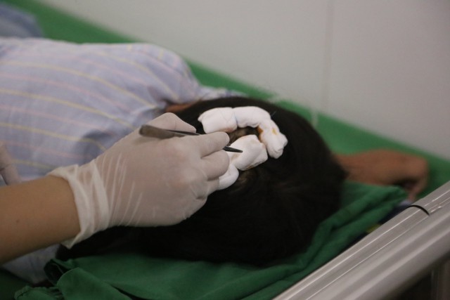 Y, bác sĩ đang thay băng cho cháu bé.