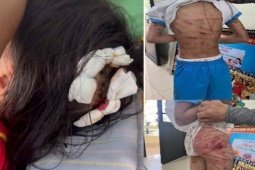 Bắt khẩn cấp cha dượng bạo hành dã man con riêng của vợ