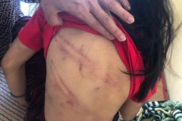 Tin tức trong ngày - Lời khai của cha dượng dùng búa đinh bạo hành bé lớp 5