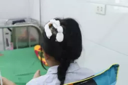 Tình trạng sức khỏe bé gái bị cha dượng dùng búa đinh đánh vào đầu