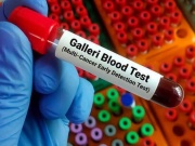 Xét nghiệm máu mới có thể phát hiện sớm hơn 50 loại ung thư