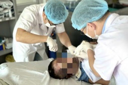 Người đàn ông không trực tiếp chạm vào dây điện vẫn bị bỏng nặng
