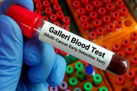 Xét nghiệm máu mới có thể phát hiện sớm hơn 50 loại ung thư