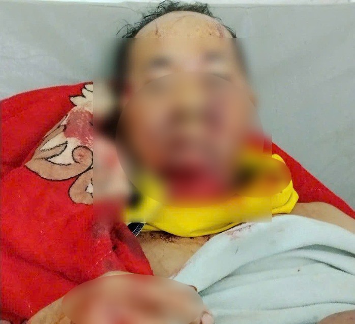 Một trưởng thôn ở Đà Nẵng bị gấu rừng tấn công - 1