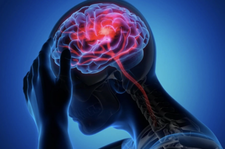 Đột quỵ 'rình rập' khi tiết trời trở lạnh đột ngột