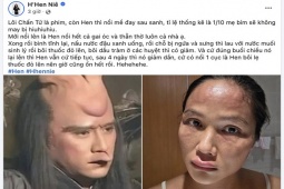 H'Hen Niê tiết lộ bị nổi mề đay sau sinh, bác sĩ nói gì về tình trạng này?