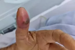 Rắn cực độc 'mai phục' trong nhà tắm cắn cụ ông nguy kịch