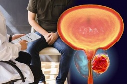 Giới khoa học tìm ra cách kìm hãm một trong những căn bệnh ung thư nguy hiểm nhất