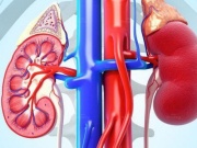 Suy thận: Nhận diện sớm các dấu hiệu cảnh báo và hướng phòng ngừa