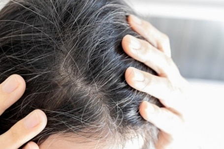 Nhóm thực phẩm ăn nhiều giúp kìm hãm tóc đen chuyển bạc
