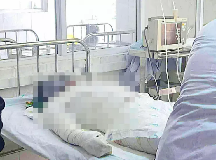 Anh NBC, nạn nhân thứ hai trong vụ phóng hỏa xảy ra ngày 19-10 đã tử vong. Ảnh: CA.