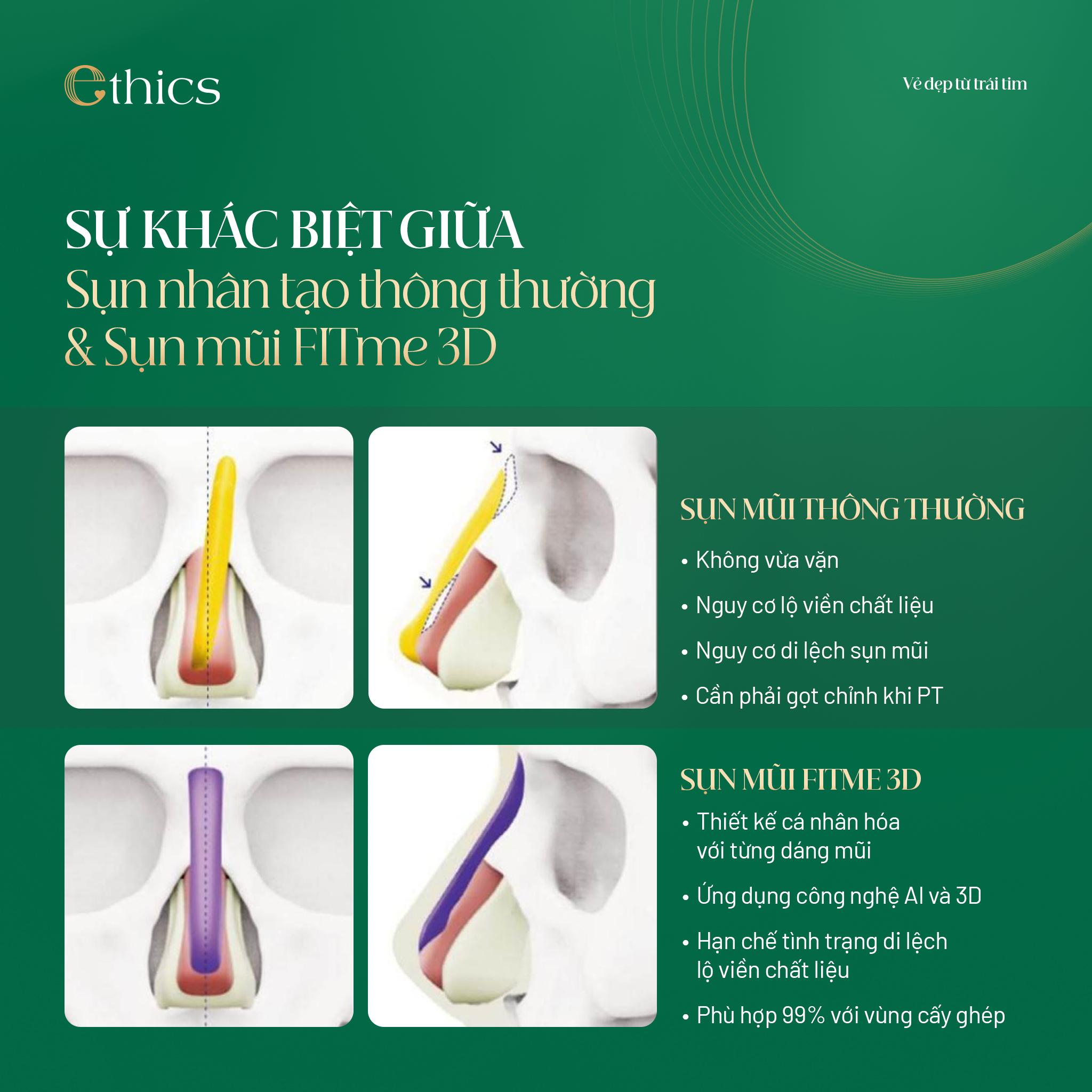 Ethics - Tiên phong ứng dụng độc quyền công nghệ nâng mũi FITme 3D - 2