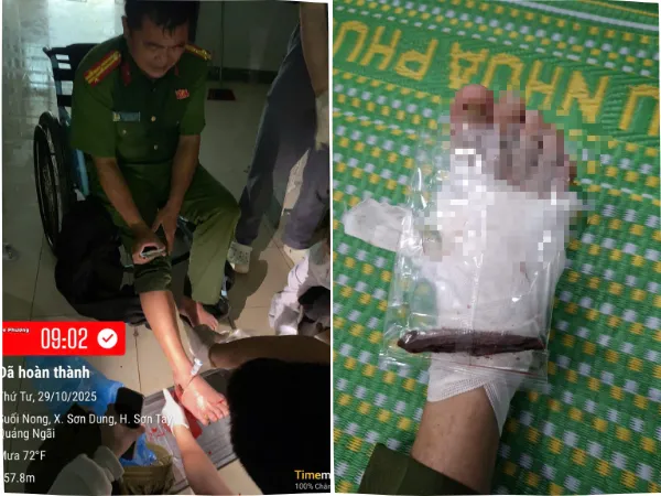 Thượng tá Đinh Quang Tiến bị thanh gỗ đâm xuyên bàn chân phải.