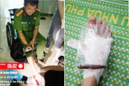 Trưởng Công an xã ở Quảng Ngãi bị gỗ đâm xuyên chân khi giúp dân chống lũ