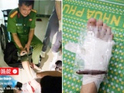 Trưởng Công an xã ở Quảng Ngãi bị gỗ đâm xuyên chân khi giúp dân chống lũ