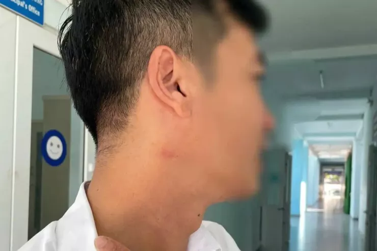 Vết xước trên cổ của một giáo viên bị ông ĐT hành hung. Ảnh: N.V
