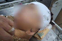 Đồng Tháp: Nữ cán bộ phường khai lý do rạch mặt người phụ nữ nhậu với chồng