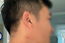 Sẽ buộc thôi việc giáo viên hành hung đồng nghiệp trong sân trường