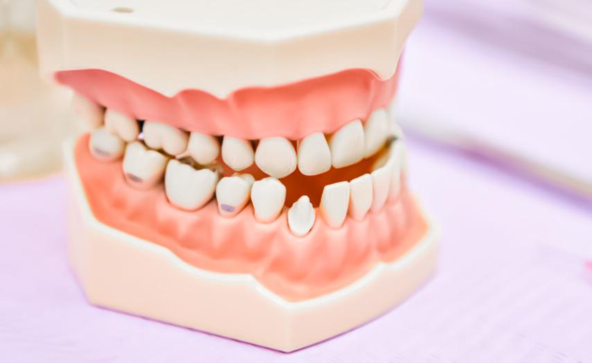 Chỉnh móm có phẫu thuật không còn phụ thuộc vào tình trạng của mỗi người