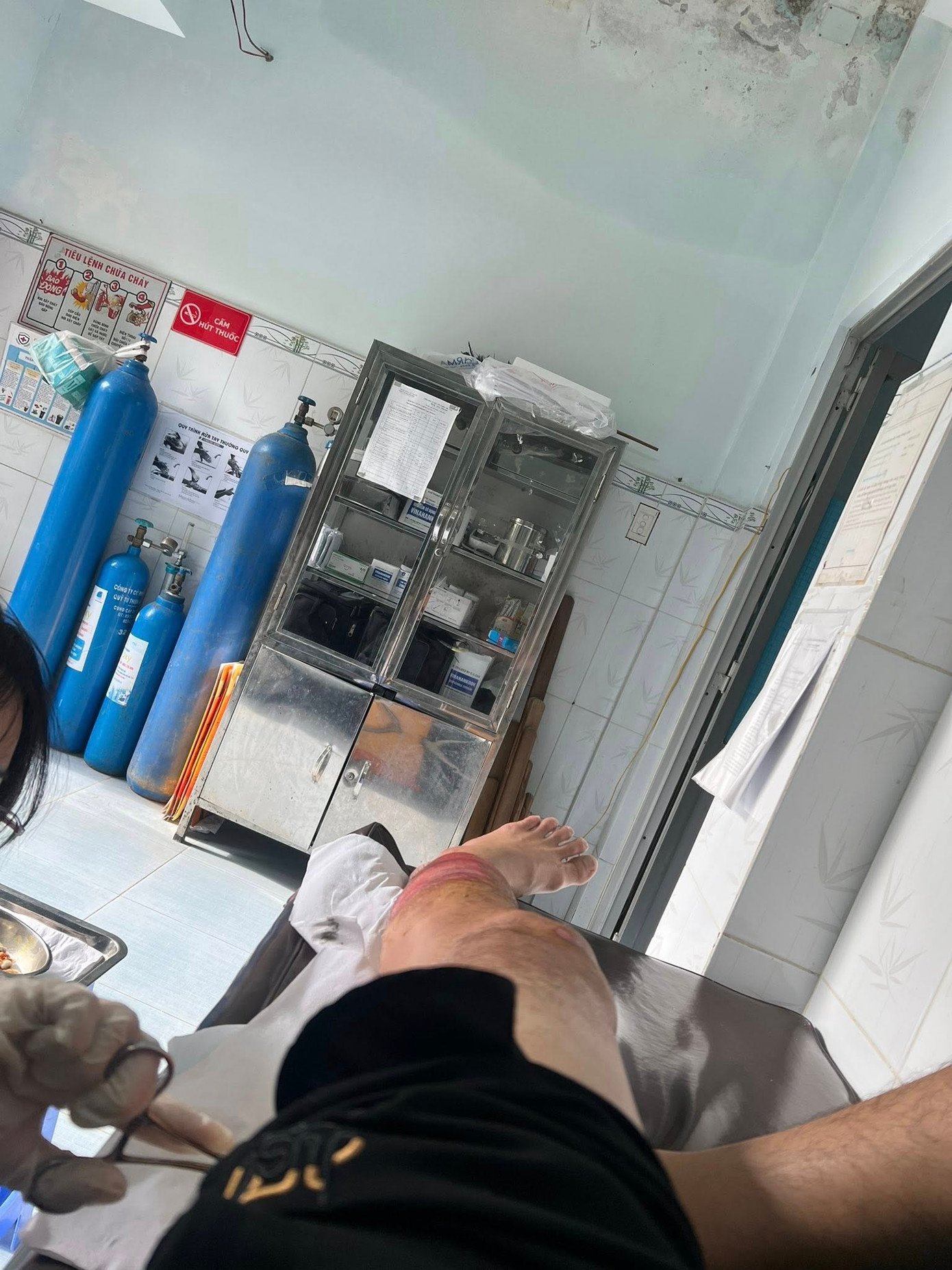 Nam nghệ sĩ chia sẻ hình ảnh của mình sau sự cố giao thông.