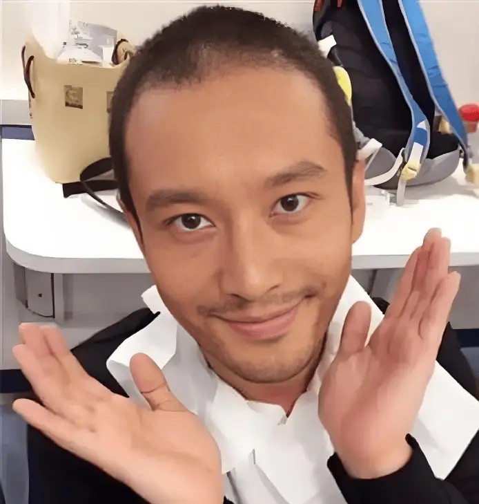 Huỳnh Hiểu Minh từng cố tình cạo trọc đầu để phù hợp với nhân vật hói đầu.