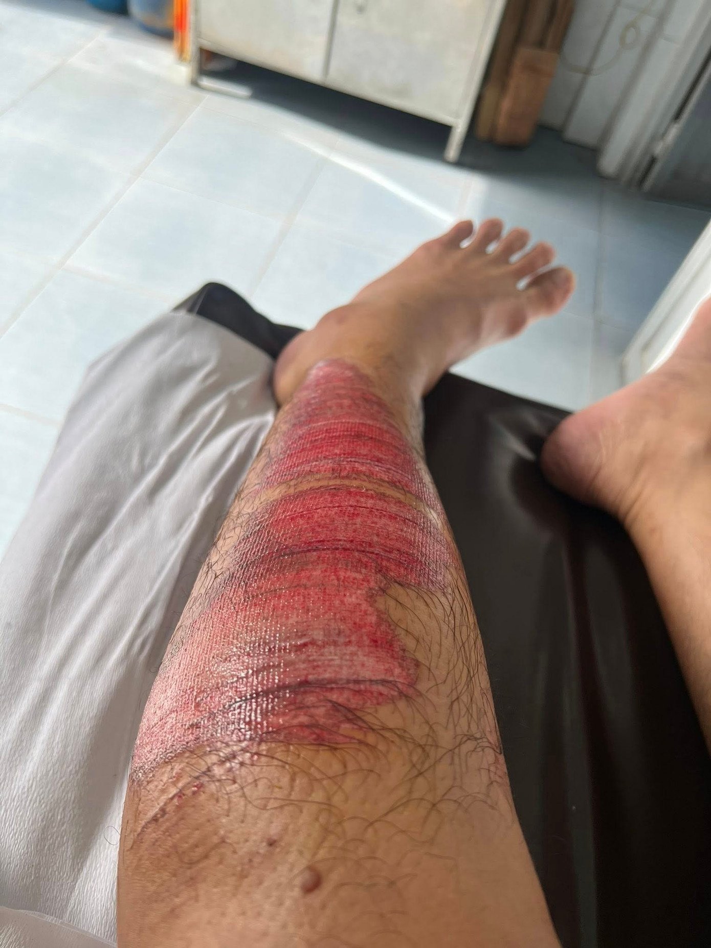 Nam nghệ sĩ chia sẻ hình ảnh của mình sau sự cố giao thông.