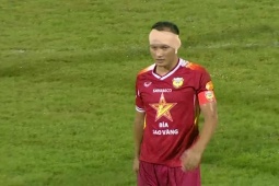 Trọng Hoàng "đổ máu", quấn băng kín đầu giúp Hà Tĩnh hạ Hà Nội ở V-League