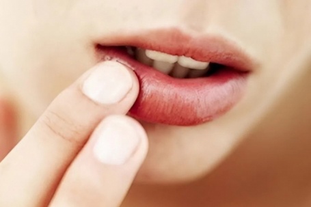 4 thói quen dễ làm tăng nguy cơ ung thư miệng